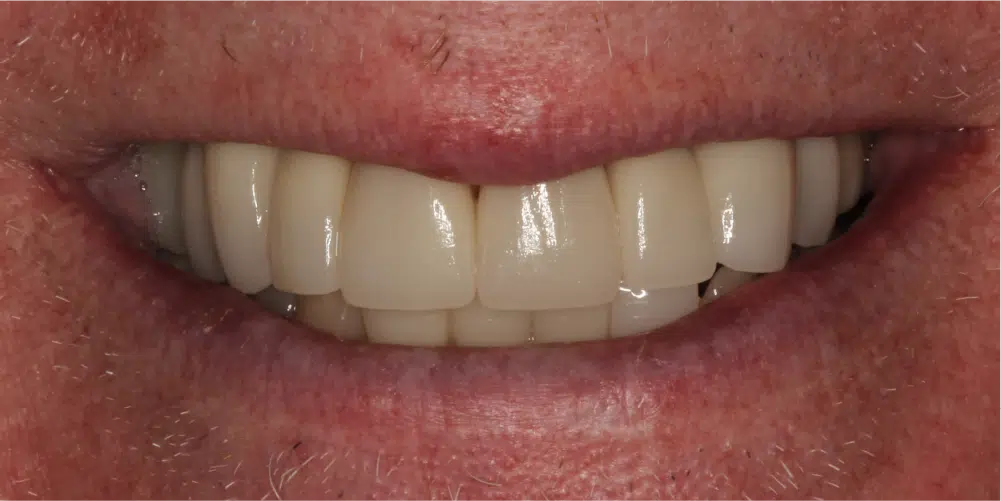 Smile Gallery in Dunwoody Dr. Amar Mistry DDS Mount Vernon Dental Group