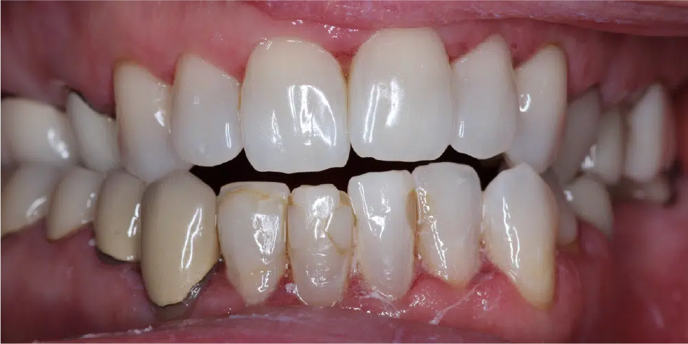 Smile Gallery in Dunwoody Dr. Amar Mistry DDS Mount Vernon Dental Group