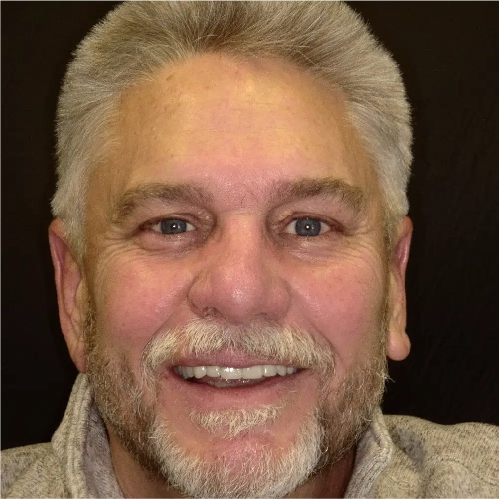 Smile Gallery in Dunwoody Dr. Amar Mistry DDS Mount Vernon Dental Group