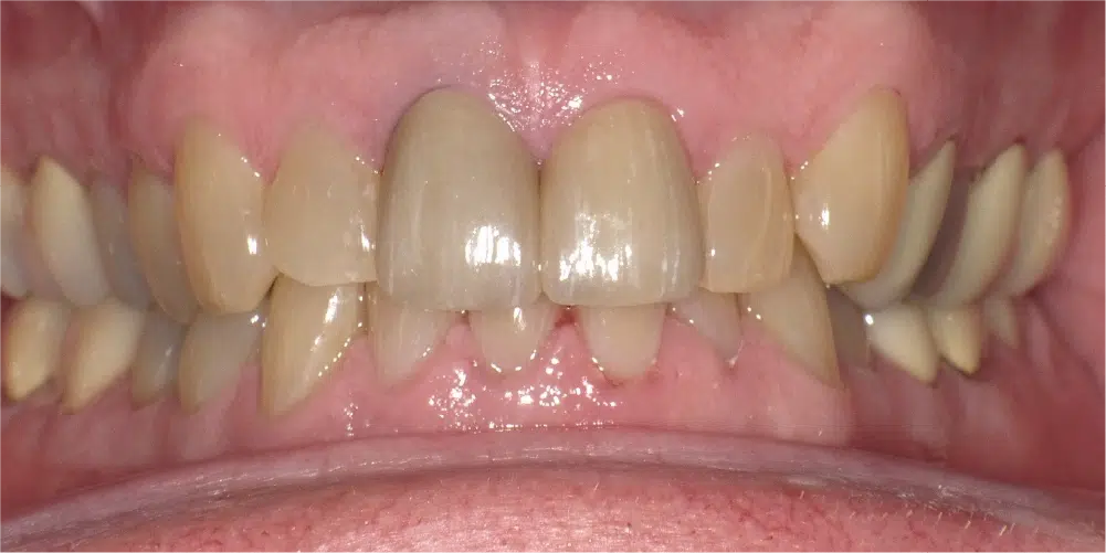 Smile Gallery in Dunwoody Dr. Amar Mistry DDS Mount Vernon Dental Group