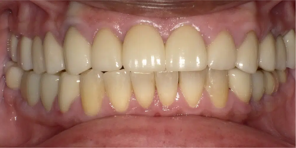 Smile Gallery in Dunwoody Dr. Amar Mistry DDS Mount Vernon Dental Group