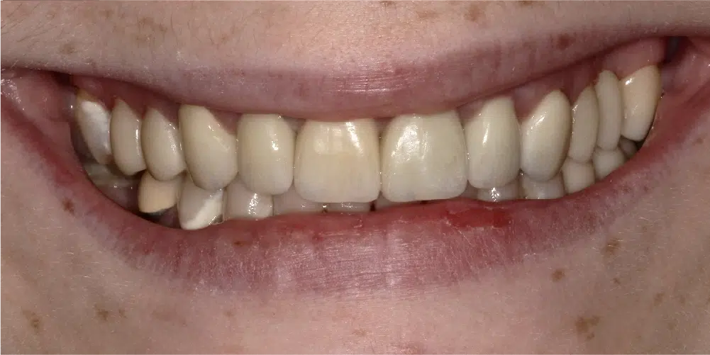 Smile Gallery in Dunwoody Dr. Amar Mistry DDS Mount Vernon Dental Group