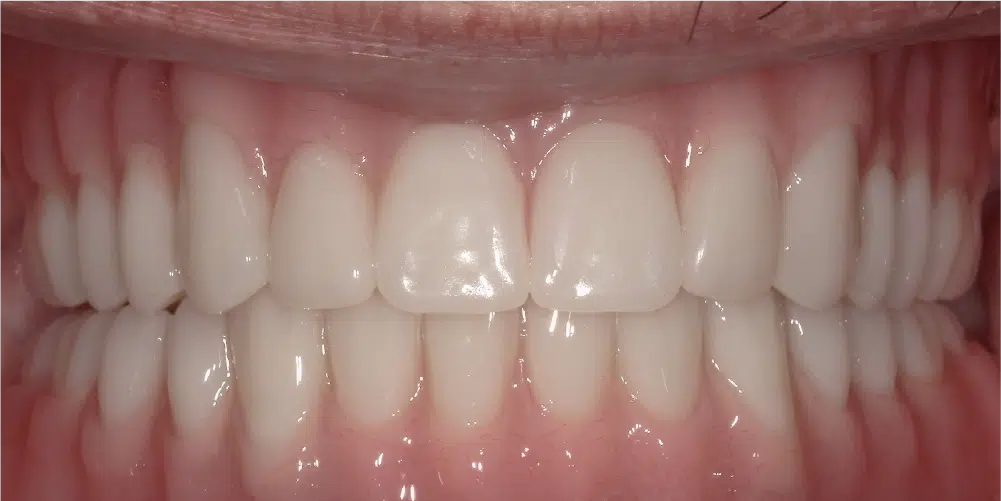 Smile Gallery in Dunwoody Dr. Amar Mistry DDS Mount Vernon Dental Group