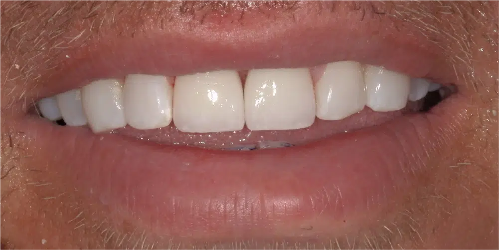 Smile Gallery in Dunwoody Dr. Amar Mistry DDS Mount Vernon Dental Group