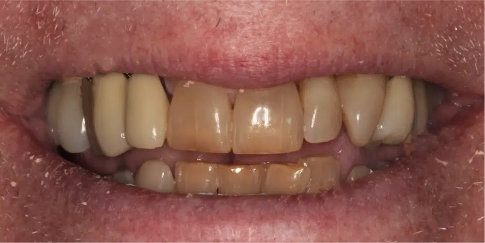 Smile Gallery in Dunwoody Dr. Amar Mistry DDS Mount Vernon Dental Group