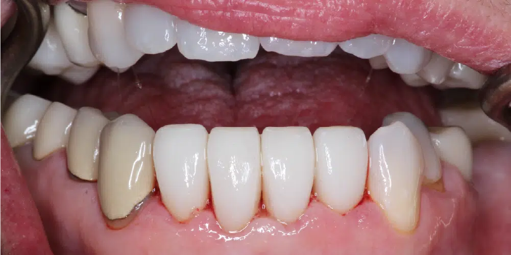 Smile Gallery in Dunwoody Dr. Amar Mistry DDS Mount Vernon Dental Group