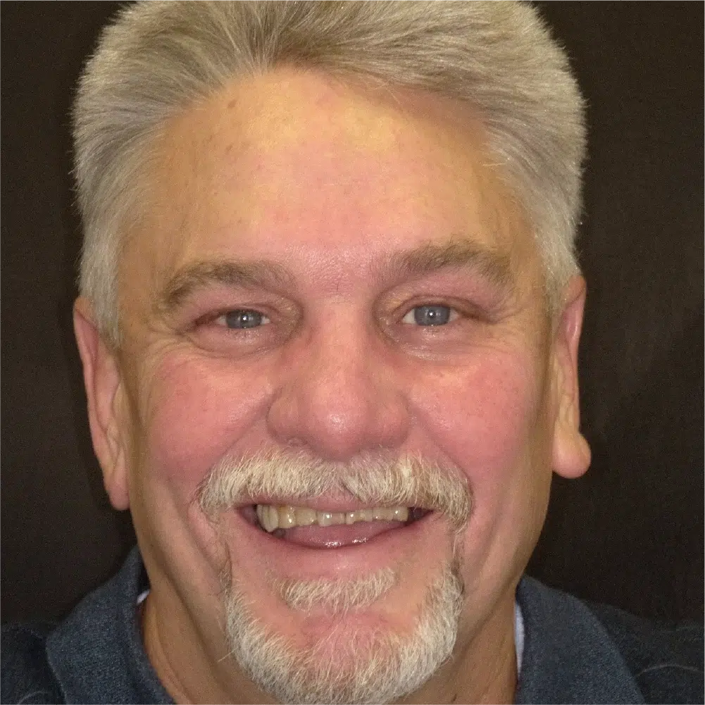 Smile Gallery in Dunwoody Dr. Amar Mistry DDS Mount Vernon Dental Group