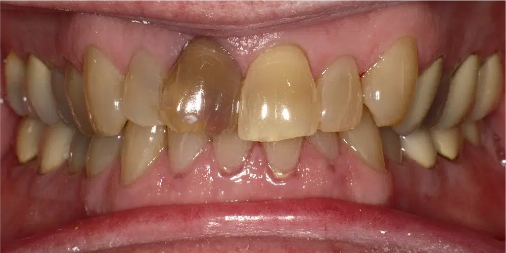Smile Gallery in Dunwoody Dr. Amar Mistry DDS Mount Vernon Dental Group