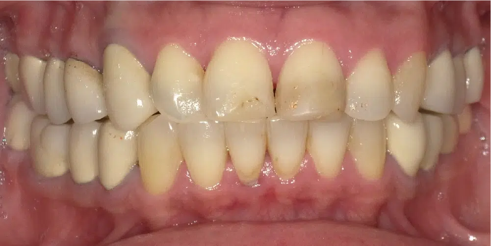 Smile Gallery in Dunwoody Dr. Amar Mistry DDS Mount Vernon Dental Group