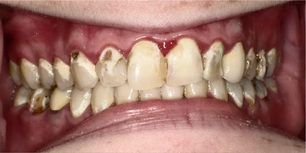 Smile Gallery in Dunwoody Dr. Amar Mistry DDS Mount Vernon Dental Group