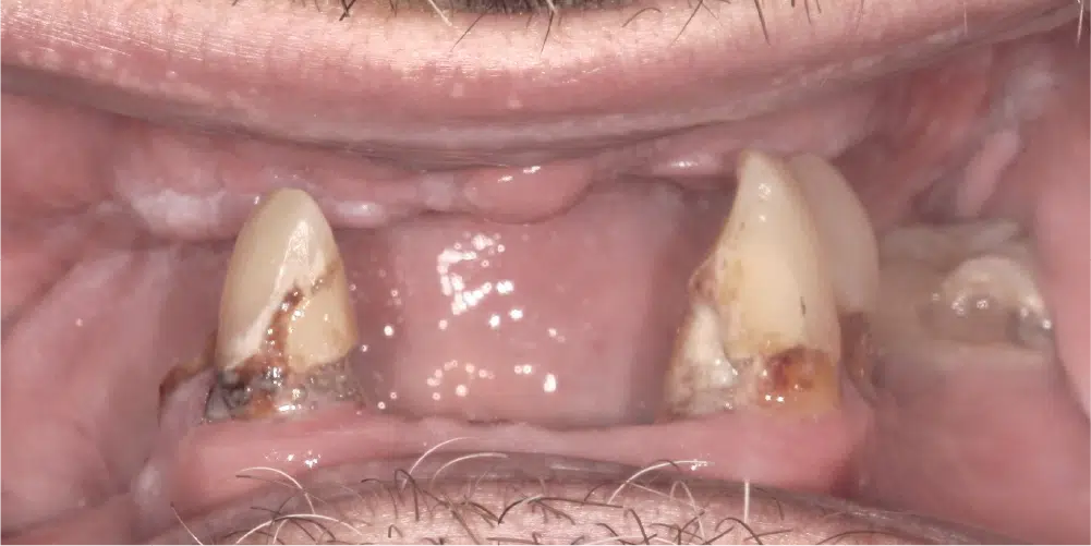 Smile Gallery in Dunwoody Dr. Amar Mistry DDS Mount Vernon Dental Group