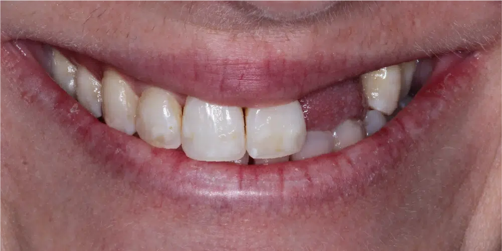 Smile Gallery in Dunwoody Dr. Amar Mistry DDS Mount Vernon Dental Group