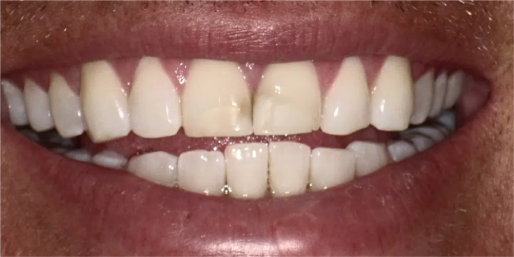 Smile Gallery in Dunwoody Dr. Amar Mistry DDS Mount Vernon Dental Group