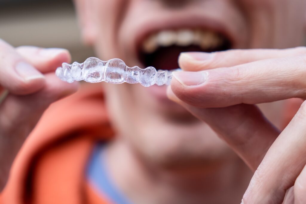 Invisalign Dunwoody